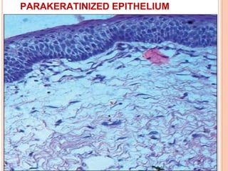epithelium-150618092512-lva1-app6892.pptx