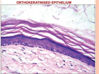 ORTHOKERATINISED EPITHELIUM
 