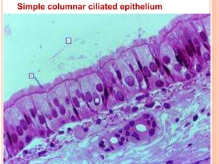 Simple columnar ciliated epithelium
 