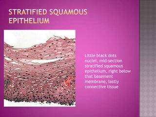 Little black dots
nuclei, mid-section
stratified squamous
epithelium, right below
that basement
membrane, lastly
connective tissue
 