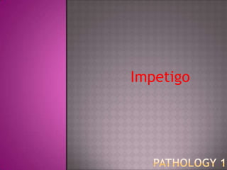 Impetigo
 