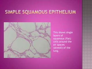 This shows single
layers of
squamous (flat)
cells around the
air spaces
(alveoli) of the
lung.
 