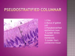 1.Cilia
2.Mucus of goblet
cell
3.Pseudostratified
epithelium layer
 4.(under three)
Basement
membrane
 5.(under four)
connective tissue
 