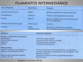 FILAMENTOS INTERMEDIÁRIOS




 Junqueira e Carneiro, 10ª Ed.
 