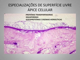ESPECIALIZAÇÕES DE SUPERFÍCIE LIVRE
           ÁPICE CELULAR
         PROTEÍNAS TRANSPORTADORAS
         AQUAPORINAS
         GLICOPROTEÍNAS E ENZIMAS HIDROLÍTICAS
 