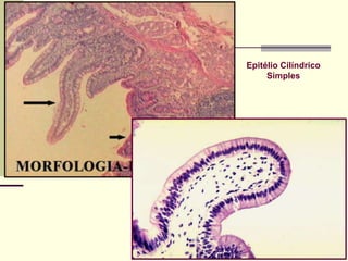 Epitélio Cilíndrico
     Simples
 