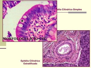 Epitélio Cilíndrico Simples




Epitélio Cilíndrico
  Estratificado
 