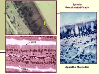 Epitélio
                                      Pseudoestratificado




                              Vilos




                                      Aparelho Mucociliar
                     Vilos
Epitélio Cilíndrico Simples
 
