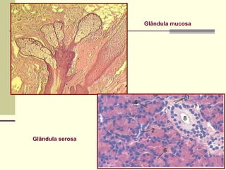 Glândula mucosa




Glândula serosa
 