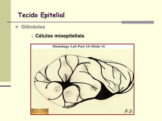 Tecido Epitelial
 Glândulas

        Células mioepiteliais
 