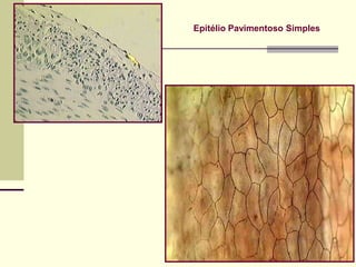 Epitélio Pavimentoso Simples
 