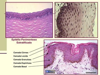 Epitélio Pavimentoso
    Estratificado


 Camada Córnea
 Camada Lúcida
 Camada Granulosa
 Camada Espinhosa
 Camada Basal
 