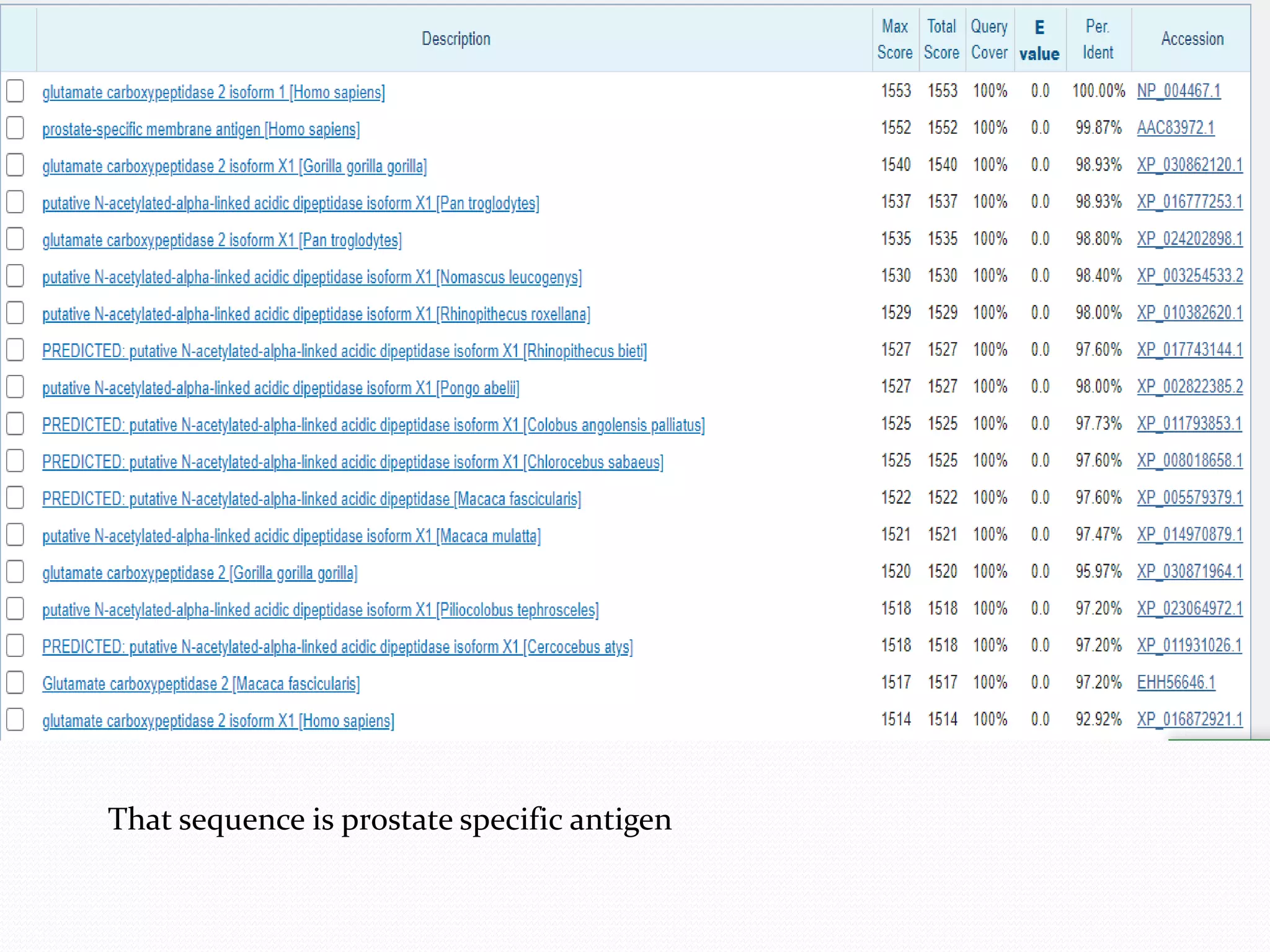 That sequence is prostate specific antigen
 