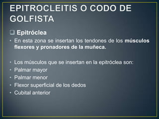 La proporción es de 1 epitrocleitis por 10
epicondilitis.
El codo de golfista es crónico y
recidivante, aunque se producen...