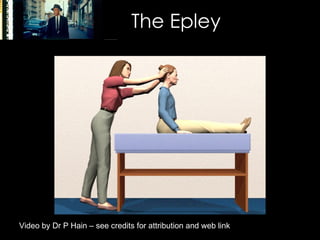 The Epley Video by Dr P Hain – see credits for attribution and web link 