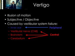 Vertigo Illusion of motion Subjective / Objective Caused by vestibular system failure:  Inner ear Vestibular nerve (CN8) Brainstem Cerebellum Peripheral Central 