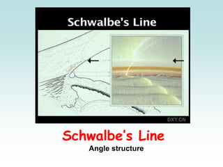 Schwalbe’s Line
Angle structure
 