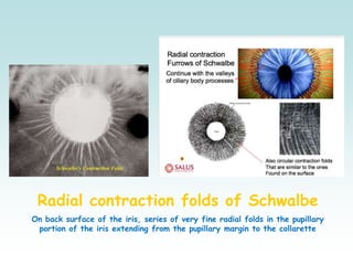 Radial contraction folds of Schwalbe
On back surface of the iris, series of very fine radial folds in the pupillary
portion of the iris extending from the pupillary margin to the collarette
 