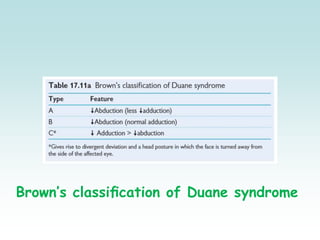 Brown’s classiﬁcation of Duane syndrome
 