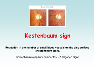Kestenbaum sign
Reduction in the number of small blood vessels on the disc surface
(Kestenbaum sign).
Kestenbaum‫׳‬s capillary number test - A forgotten sign?
 