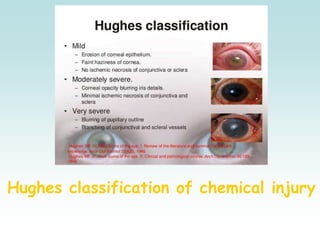 Hughes classification of chemical injury
 