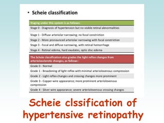 Scheie clssification of
hypertensive retinopathy
 