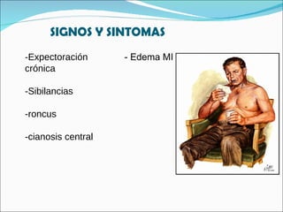 SIGNOS Y SINTOMAS -Expectoración  crónica -Sibilancias -roncus -cianosis central - Edema MI 