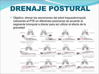 DRENAJE POSTURAL Objetivo: drenar las secreciones del arbol traqueobronquial, colocando al PTE en diferentes posiciones de acuerdo al segmente bronquial a drenar para así utilizar el efecto de la gravedad 