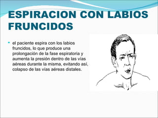 ESPIRACION CON LABIOS FRUNCIDOS el paciente espira con los labios fruncidos, lo que produce una prolongación de la fase espiratoria y aumenta la presión dentro de las vías aéreas durante la misma, evitando así, el colapso de las vías aéreas distales. 