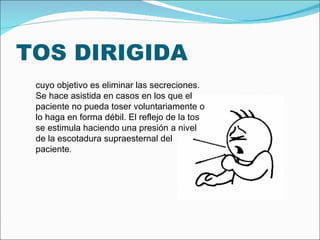 TOS DIRIGIDA cuyo objetivo es eliminar las secreciones. Se hace asistida en casos en los que el paciente no pueda toser voluntariamente o lo haga en forma débil. El reflejo de la tos se estimula haciendo una presión a nivel de la escotadura supraesternal del paciente . 