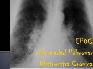EPOCenfermedad Pulmonar Obstructiva Crónica 