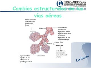 Cambios estructurales de las vías aéreas 