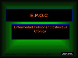 E.P.O.C Enfermedad Pulmonar Obstructiva Crónica  Erson jara E. 