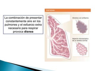 La combinación de presentar
 constantemente aire en los
pulmones y el esfuerzo extra
   necesario para respirar
      provoca disnea
 