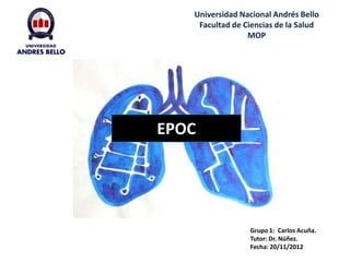EPOC
Universidad Nacional Andrés Bello
Facultad de Ciencias de la Salud
MOP
Grupo 1: Carlos Acuña.
Tutor: Dr. Núñez.
Fecha: 20/11/2012
 