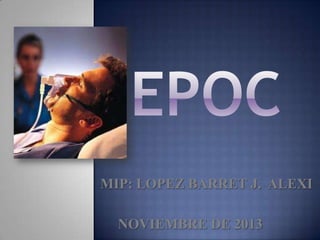 MIP: LOPEZ BARRET J. ALEXI
NOVIEMBRE DE 2013

 