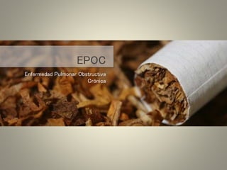 EPOC
Enfermedad Pulmonar Obstructiva
Crónica
 