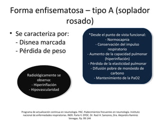Forma enfisematosa – tipo A (soplador
rosado)
• Se caracteriza por:
- Disnea marcada
- Pérdida de peso
Programa de actualización continua en neumología. PAC. Padecimientos frecuentes en neumología. Instituto
nacional de enfermedades respiratorias. INER. Parte ll. EPOC. Dr. Raúl H. Sansores, Dra. Alejandra Ramírez
Venegas. Pp. 99-144
*Desde el punto de vista funcional:
- Normocapnia
- Conservación del impulso
respiratorio
- Aumento de la capacidad pulmonar
(hiperinflación)
- Pérdida de la elasticidad pulmonar
- Difusión pobre de monóxido de
carbono
- Mantenimiento de la PaO2
*Desde el punto de vista funcional:
- Normocapnia
- Conservación del impulso
respiratorio
- Aumento de la capacidad pulmonar
(hiperinflación)
- Pérdida de la elasticidad pulmonar
- Difusión pobre de monóxido de
carbono
- Mantenimiento de la PaO2
Radiológicamente se
observa:
- Hiperinflación
- Hipovascularidad
Radiológicamente se
observa:
- Hiperinflación
- Hipovascularidad
 