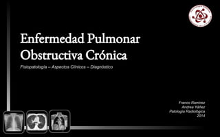 Enfermedad Pulmonar
Obstructiva Crónica
Fisiopatología – Aspectos Clínicos – Diagnóstico
Franco Ramírez
Andrea Yáñez
Patología Radiológica
2014
 