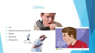 Clínica
 Tos
 Expectoraciones purulentas
 Disnea
 Adinamia
 Hemoptisis
 