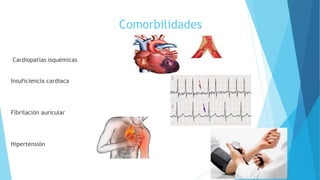 Comorbilidades
Cardiopatías isquémicas
Insuficiencia cardiaca
Fibrilación auricular
Hipertensión
 