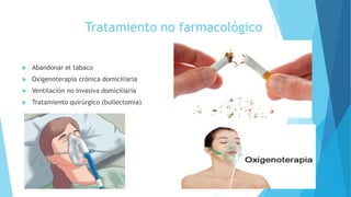 Tratamiento no farmacológico
 Abandonar el tabaco
 Oxigenoterapia crónica domiciliaria
 Ventilación no invasiva domiciliaria
 Tratamiento quirúrgico (bullectomia)
 