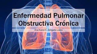 Enfermedad Pulmonar
Obstructiva Crónica
Ana Karen E. Delgado Loera
 
