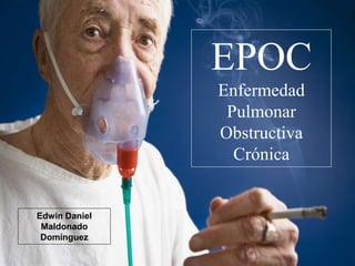 EPOC
Enfermedad
Pulmonar
Obstructiva
Crónica
Edwin Daniel
Maldonado
Domínguez
 