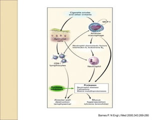 Barnes P. N Engl J Med 2000;343:269-280
Inflammatory Mechanisms in Chronic Obstructive Pulmonary Disease
 