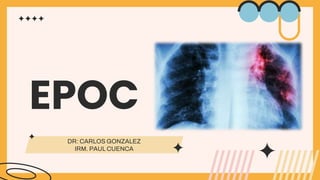 EPOC
DR: CARLOS GONZALEZ
IRM. PAUL CUENCA
 