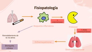 Fisiopatología
Remodelamiento de
la vía aérea
Respuesta inflamatoria Proteasas
Destrucción pulmonar
Enfisema pulmonar
X
antiproteinasas
X células
mesenquimatosas
Bronquitis
crónica
 