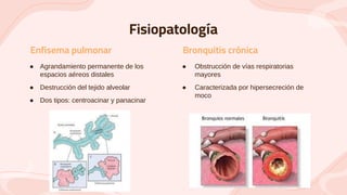 Fisiopatología
● Obstrucción de vías respiratorias
mayores
● Caracterizada por hipersecreción de
moco
● Agrandamiento permanente de los
espacios aéreos distales
● Destrucción del tejido alveolar
● Dos tipos: centroacinar y panacinar
Enfisema pulmonar Bronquitis crónica
 