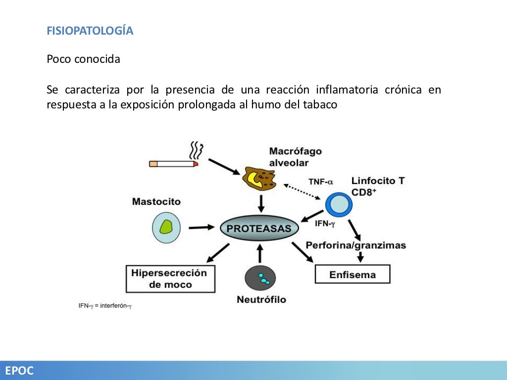 EPOC Caso clínico