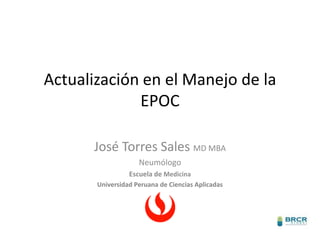 Actualización en el Manejo de la
EPOC
José Torres Sales MD MBA
Neumólogo
Escuela de Medicina
Universidad Peruana de Ciencias Aplicadas

 